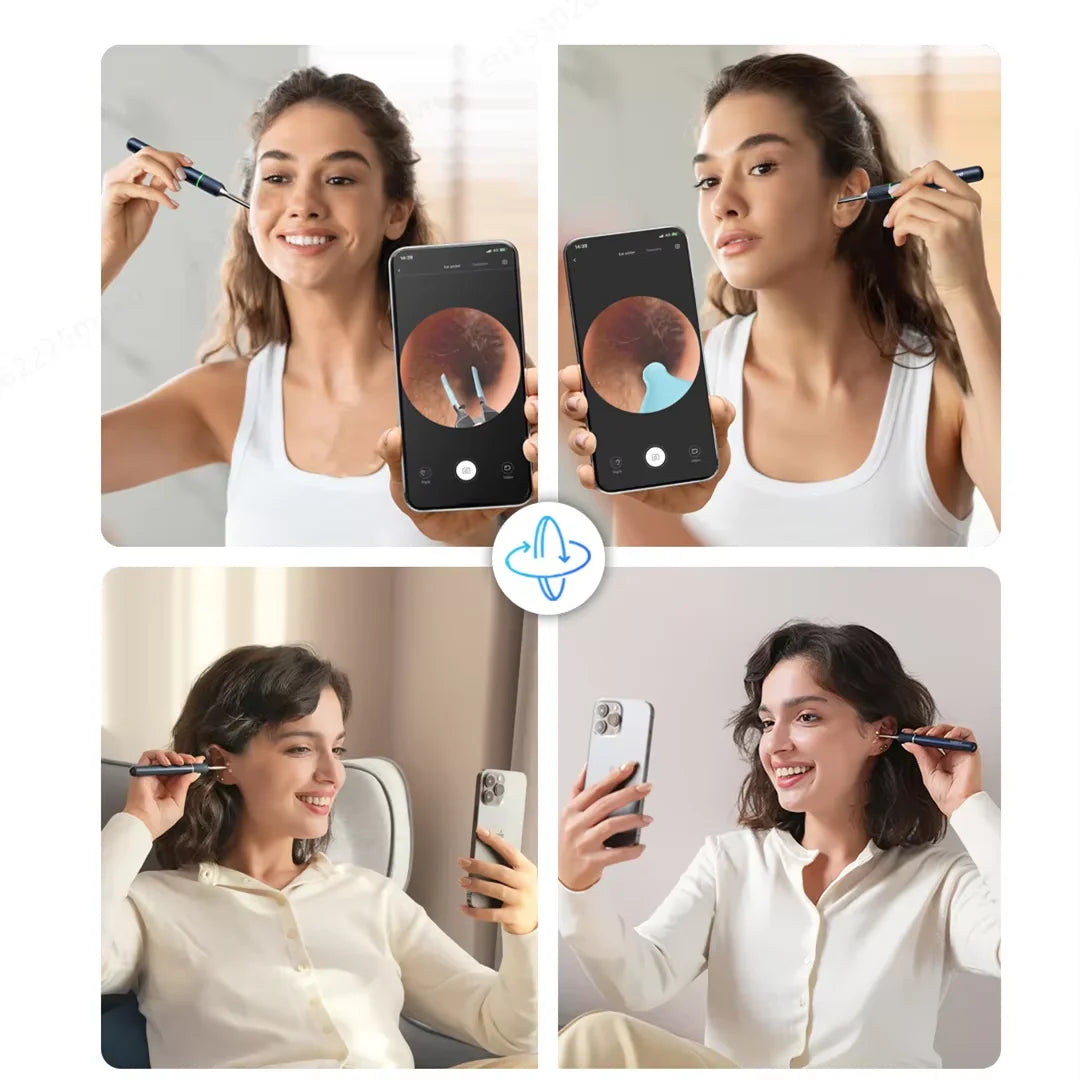 Bebird Note5 Pro Smart Visual Ear Cleaning Tool - 10MP Camera and Tweezers – Personal Care Ki