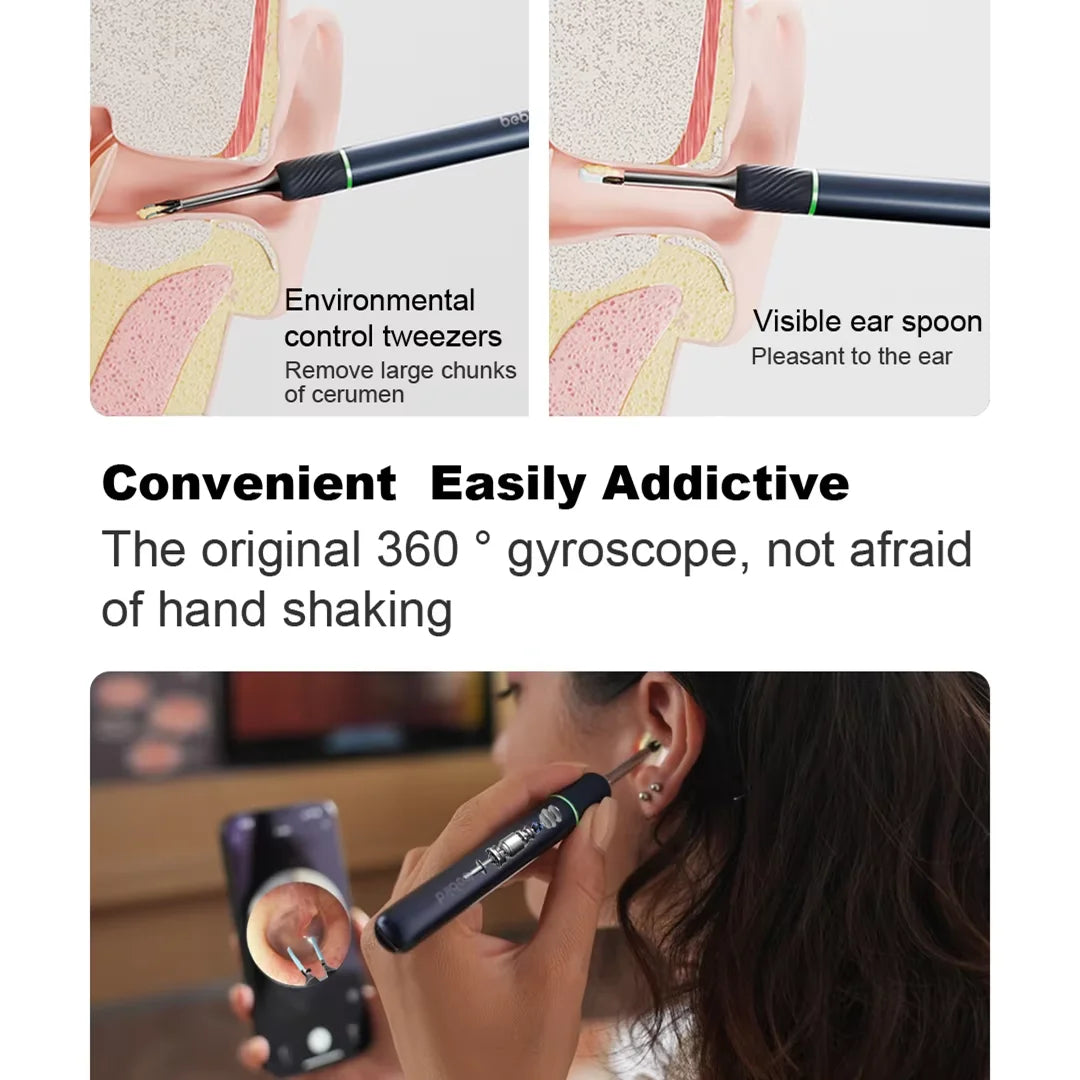 Bebird Note5 Pro Smart Visual Ear Cleaning Tool - 10MP Camera and Tweezers – Personal Care Ki