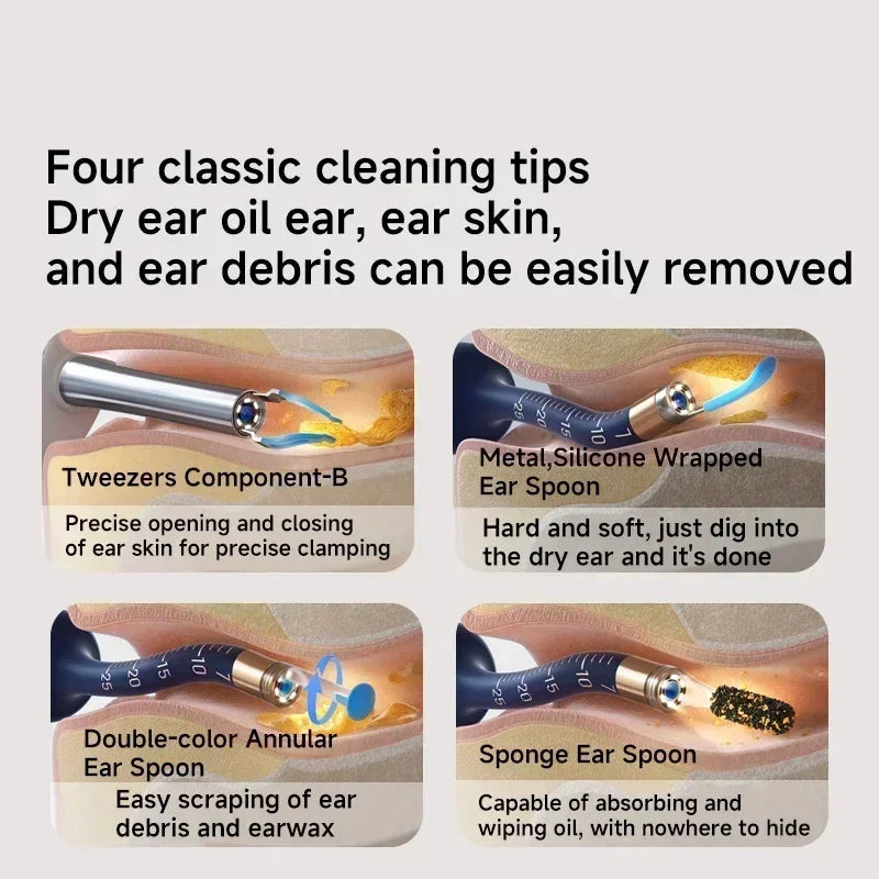 Bebird EarSight Plus R37R – Visual Ear Cleaning Tool with 10MP HD Camera (White Edition)