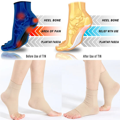 Arch support